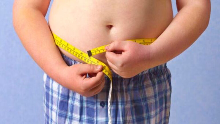 Obesidad es la forma más común de malnutrición infantil en el mundo este 2025, alerta UNICEF