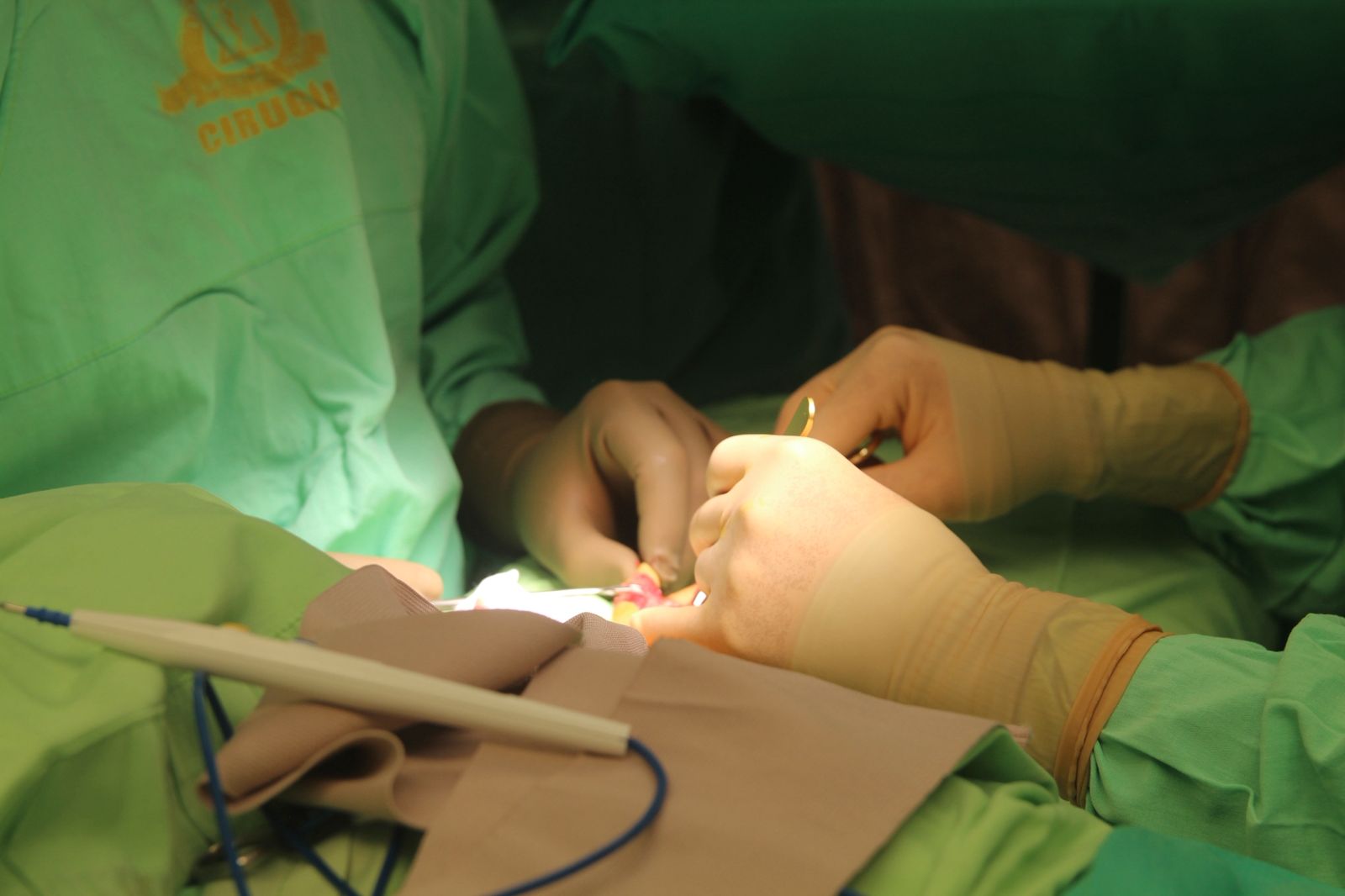 Fotografia del procedimiento propia de Clinica Universitaria Union Medica del Norte