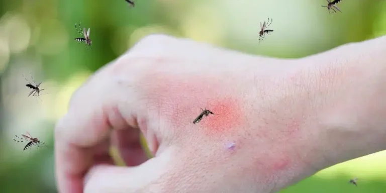 Notifican dos nuevos casos de malaria durante los siete días de la Semana Epidemiológica número 49