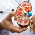 Nefróloga de Cleveland Clinic asegura que chequeos médicos son claves para proteger salud renal