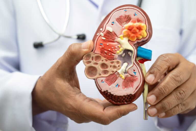 Nefróloga de Cleveland Clinic asegura que chequeos médicos son claves para proteger salud renal