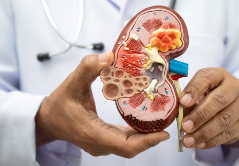 Nefróloga de Cleveland Clinic asegura que chequeos médicos son claves para proteger salud renal