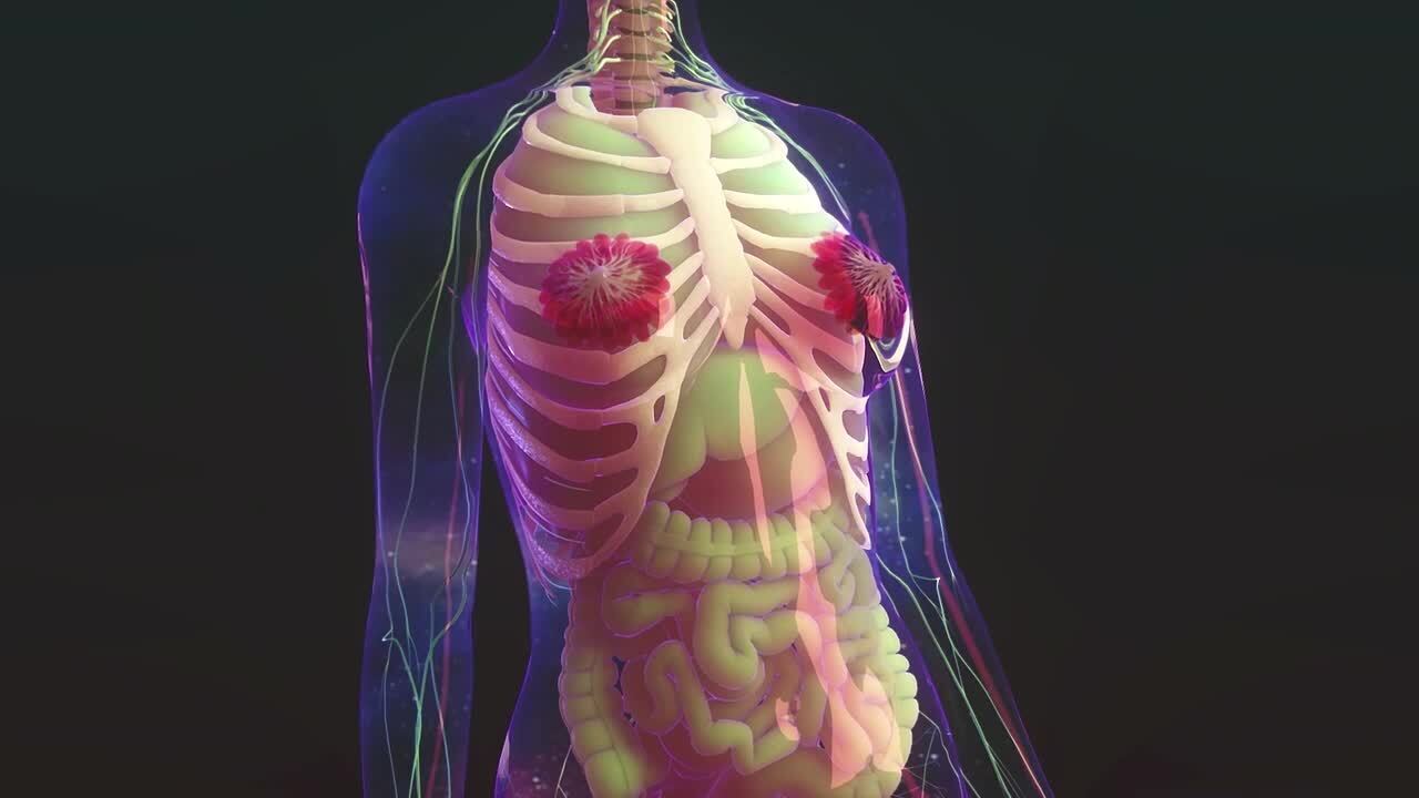 Cáncer de mama: por qué el tratamiento puede debilitar los huesos