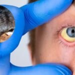 MSP reporta 3 nuevos casos de leptospirosis en el país