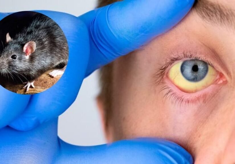 MSP reporta 3 nuevos casos de leptospirosis en el país