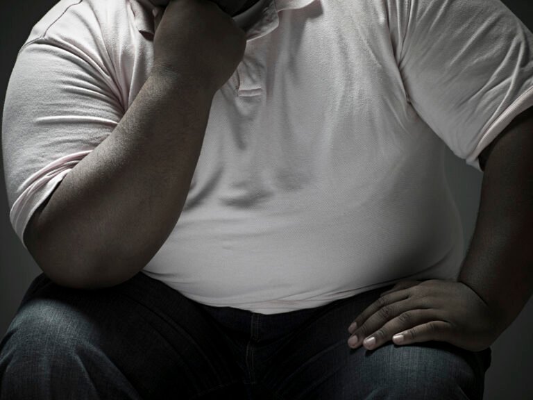 El 78% de las personas que viven con obesidad sufre estrés postraumático debido al estigma que carga la enfermedad
